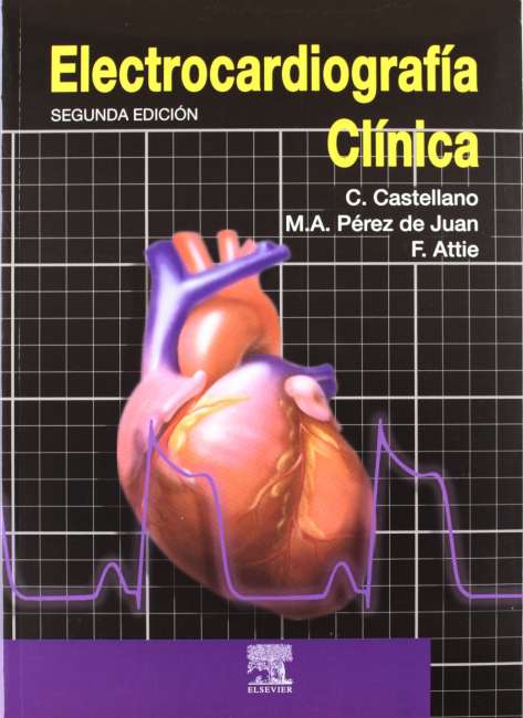 Electrocardiografía Clínica - Castellano