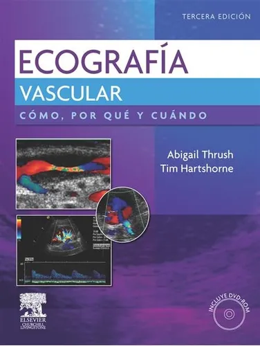 Ecografía Vascular - Abigail Thrush EN PDF 