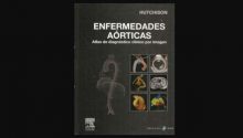 Enfermedades Aórticas Atlas de Diagnóstico Clínico por Imagen - Hutchison EN PDF